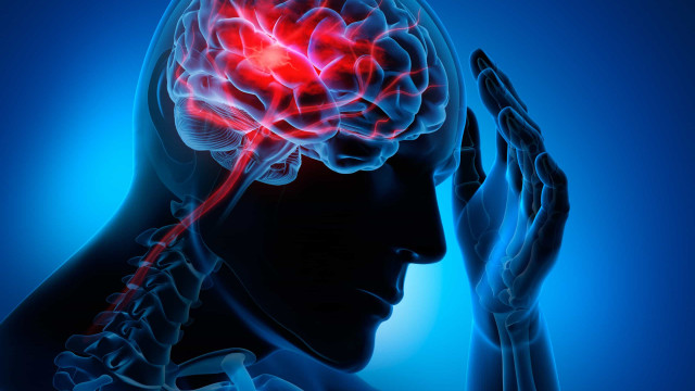 AVC: entenda a ameaça silenciosa que é a segunda causa de morte no mundo