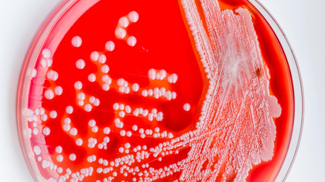 Bactéria "devoradora de carne" preocupa Japão: casos atingem recorde