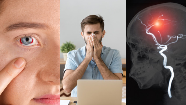 Os perigos de segurar um espirro!