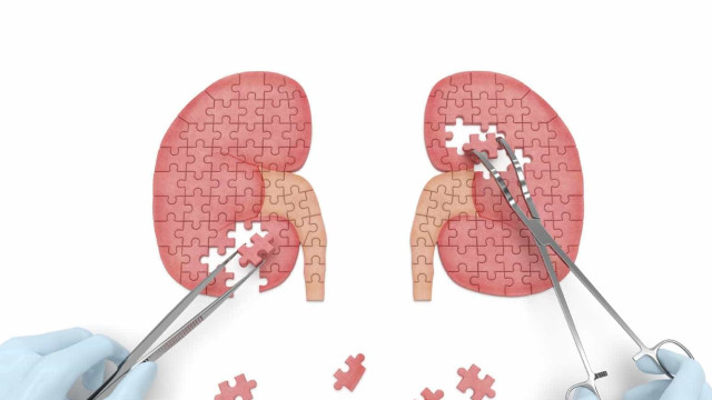 Pedras nos rins podem levar à doença renal crônica?