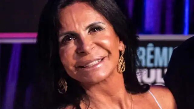 Gretchen rebate críticas após mostrar calvície:"Não tenho vergonha"