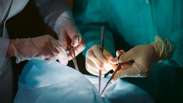 Pacientes são contaminados com HIV após transplante de órgãos no RJ