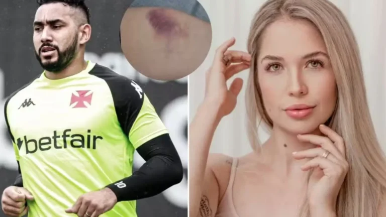Payet nega agressão, mas diz que beber urina era comum entre o casal