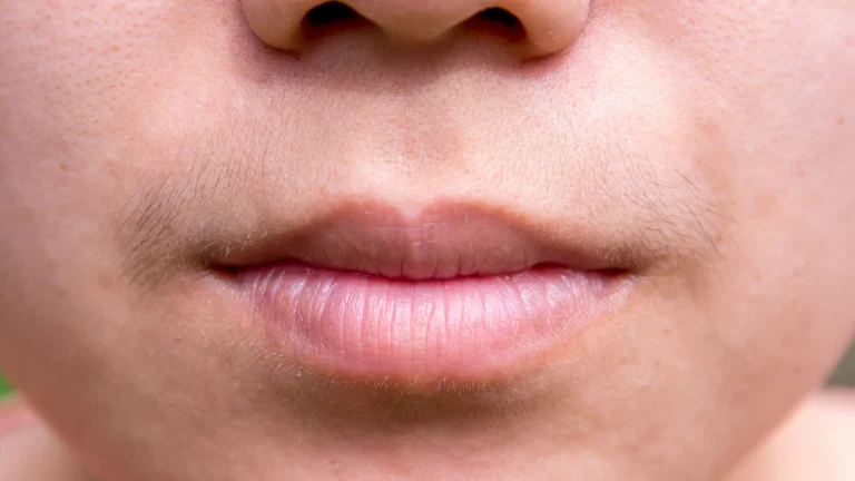 Testosterona em mulheres: Tudo o que precisa saber