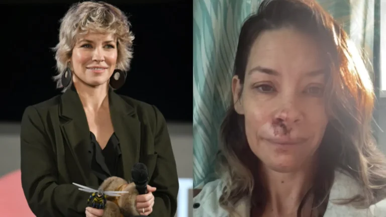 Evangeline Lilly, estrela de ‘Lost’, sofre acidente na praia