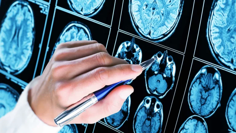 Teste ocular detecta autismo em bebês com 80% de precisão