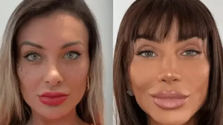 Entenda os riscos da cirurgia feita por Andressa Urach e Maya Massafera para mudar a cor dos olhos
