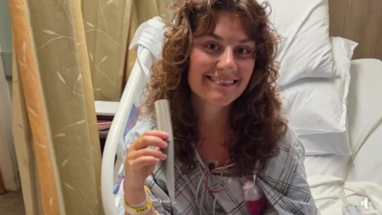 Salva-vidas fica à beira da morte após ser empalada por guarda-sol