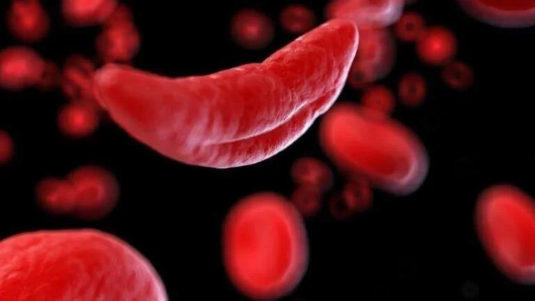 Patologia hereditária: cinco fatos sobre a Doença Falciforme