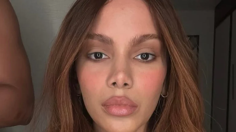 Se quiser o Smigle ou o Fofão, eu viro’, diz Anitta sobre procedimento no rosto