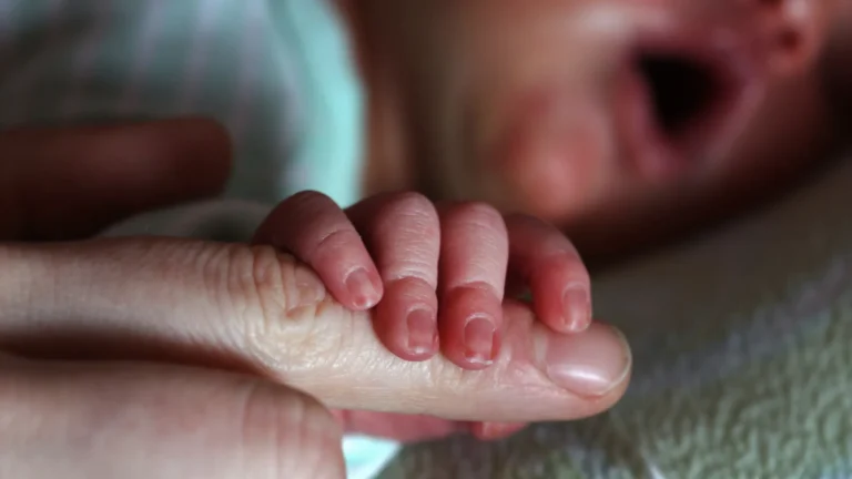 Bebê desenvolve genitália masculina após contato com gel hormonal do pai
