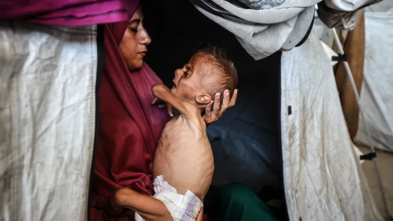 É impossível negar: a fome em Gaza é real e devastadora; veja as imagens