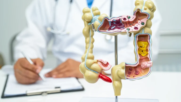 Alimento reduz em 20% o risco de câncer de intestino, revela novo estudo