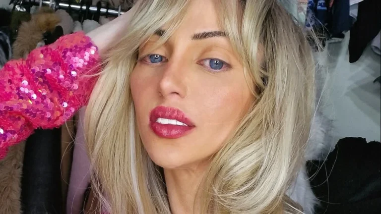 Causa da morte da influenciadora chamada de “Barbie humana” é revelada