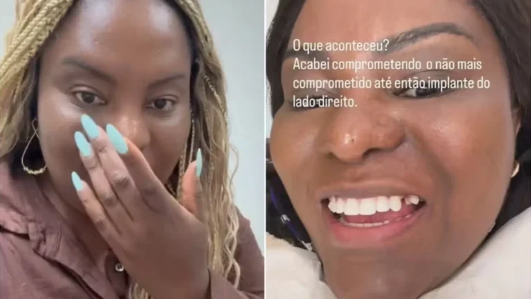 Ex-Rouge enfrenta imprevisto dental antes do Carnaval