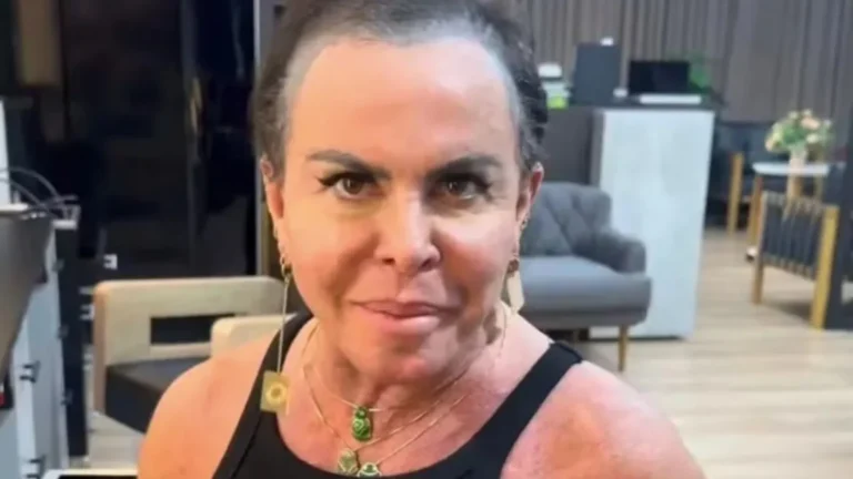 Gretchen aparece sem prótese capilar e anuncia doação de lace