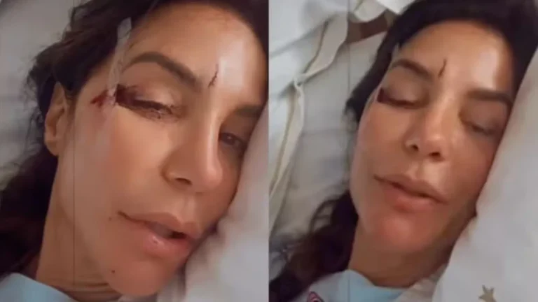 Ivete é hospitalizada após passar mal e desmaiar: ‘Caí no chão com tudo’