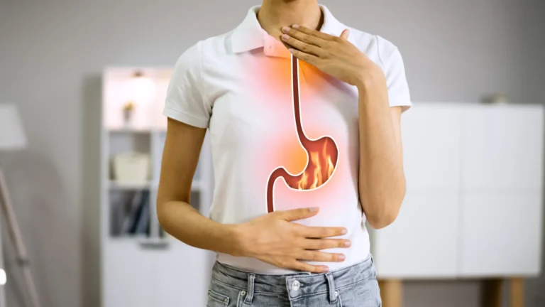Médicos revelam os piores alimentos para quem sofre de azia