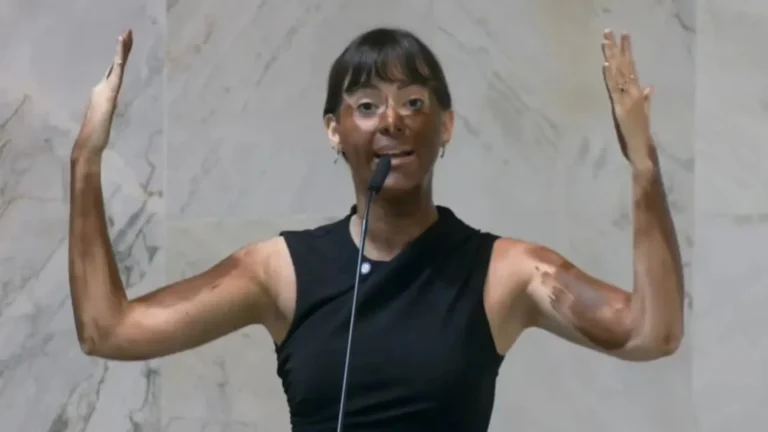Deputada Fabiana Bolsonaro faz ‘blackface’ em protesto transfóbico